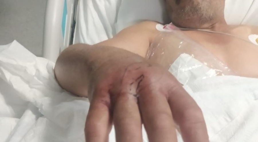 Narenciye toplayan çiftçiyi yılan soktu