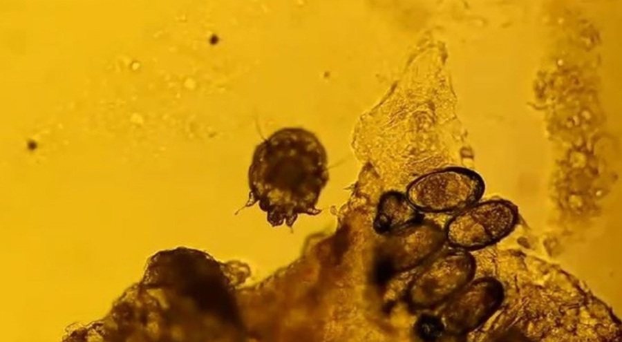 Bu hastalığa dikkat! Vaka sayıları günden güne artıyor