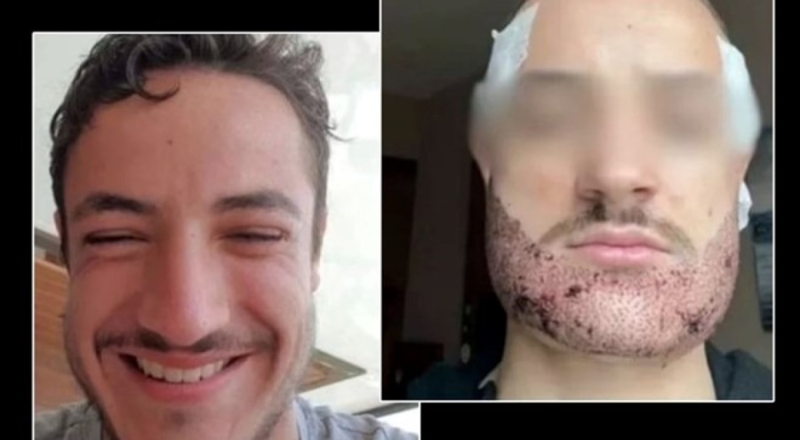 Sakal ekimi sonrası intihar iddiası: "Operasyonu yapan doktor değil, emlakçı!"