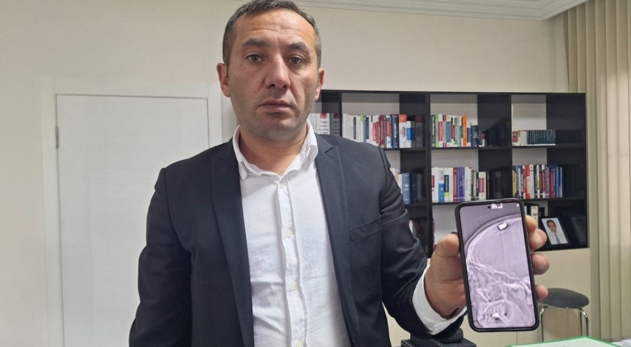 Adres sorma kavgasında başından vurulan Savaş Koç: "Ölü taklidi yaparak uzaklaşmasını bekledim"