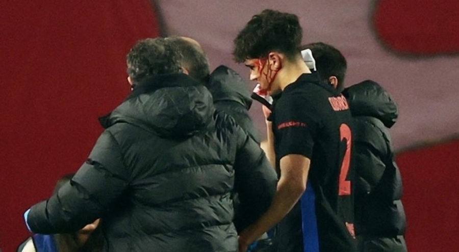 Futbolcu Pau Cubarsi yüzüne darbe aldı! Yüzüne 10 dikiş atıldı