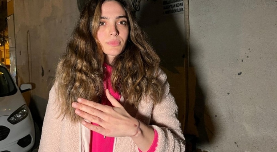 Dövme sildirmek isteyen kadının kolu yandı