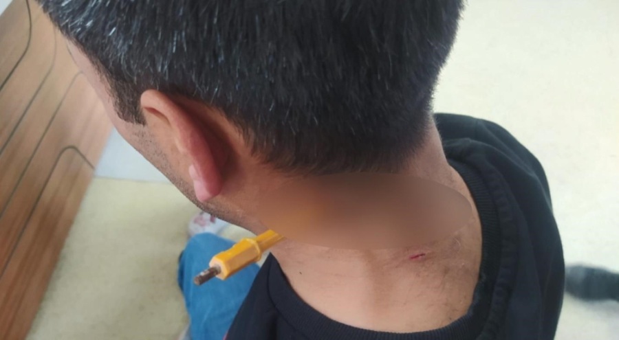 Park yeri kavgasında boynuna tornavida sapladı