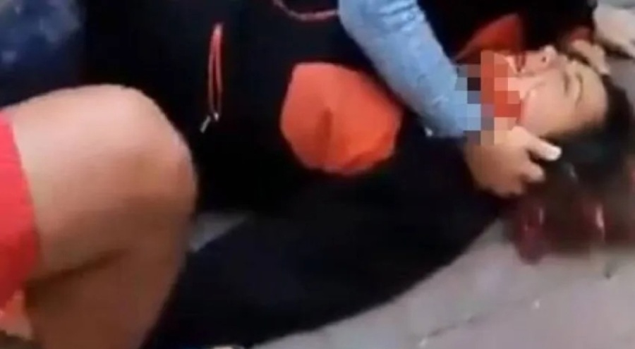 Profesör köpeklerin saldırısında yaralandı!