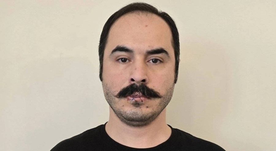 İranlı aktivist Hüseyin Roneki dudaklarını dikti