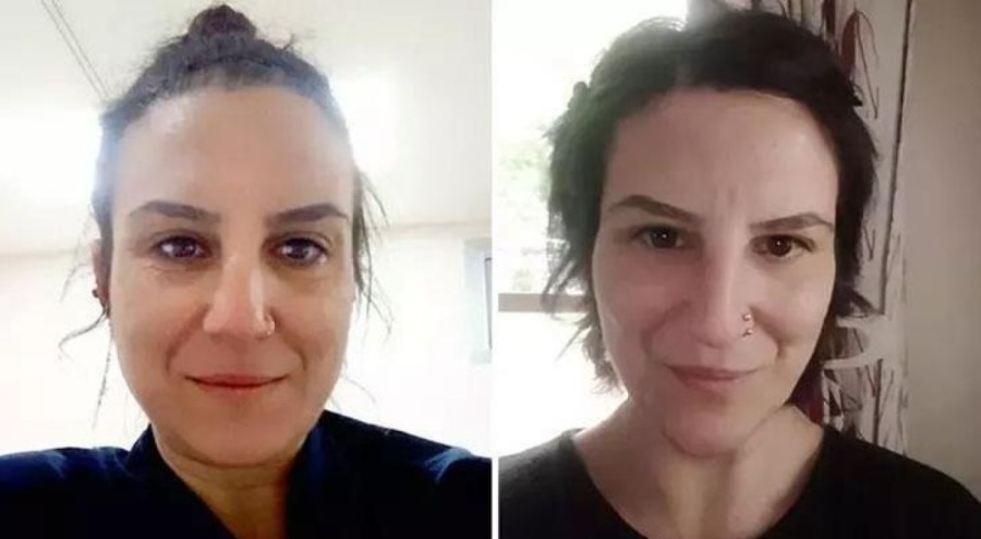 Kahreden olay! Dilek hemşire yaşamını yitirdi