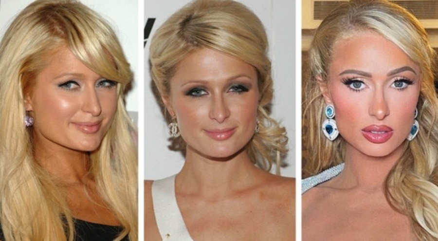 Paris Hilton: 'Tamamen doğalım, hiç estetik yaptırmadım'