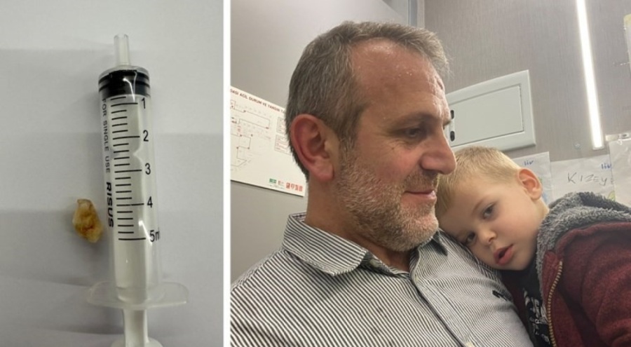 2 yaşındaki çocuğun 'öksürüğünün' sebebi şoke etti!