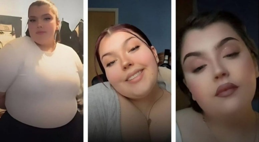 Türkiye'deki mide ameliyatı sonu oldu: Bağırsaklarını kesmişler