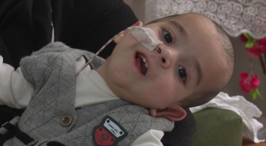 Bursa'da SMA hastası Barış bebek yardım eli bekliyor