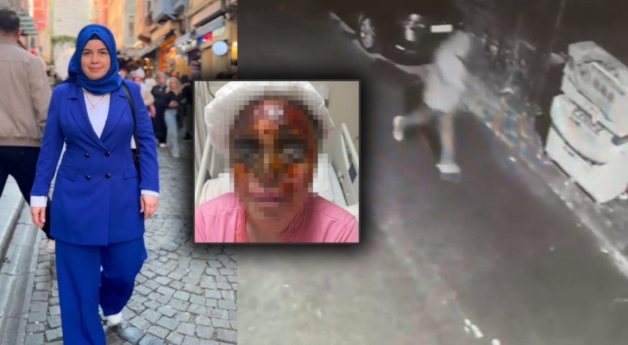 Kendisini 'Babam yaşındasın' diyerek reddeden kadının yüzüne kezzap attı!