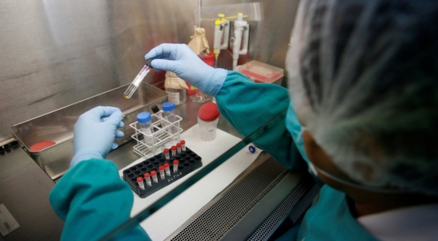 ABD'de tüberküloz vakalarında artış sürüyor