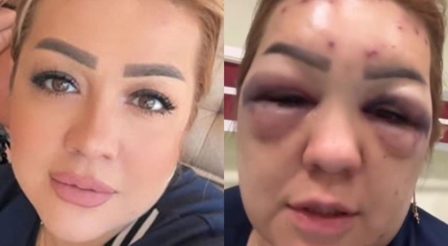 Estetik merkezinde kabusu yaşadı: Bilmediğiniz hiçbir yere gitmeyin