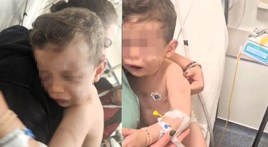 Öldüresiye darbedilen 2 yaşındaki çocuğun annesi ile annesinin sevgilisi gözaltında