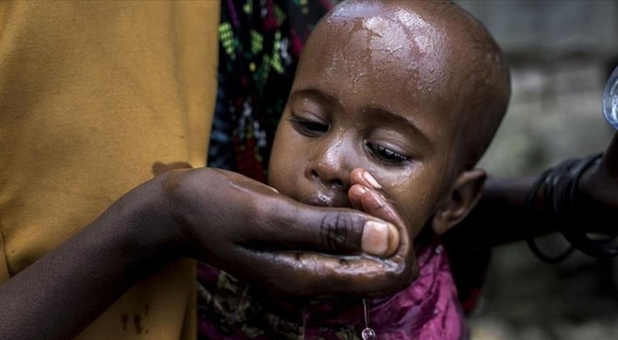 UNICEF: 1 milyondan fazla çocuk kolera riski altında