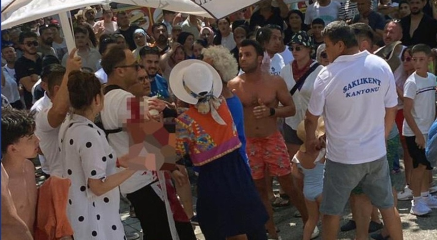 Ailesiyle kanyonda yürüyüş yaparken başına taş düşen çocuk ağır yaralandı