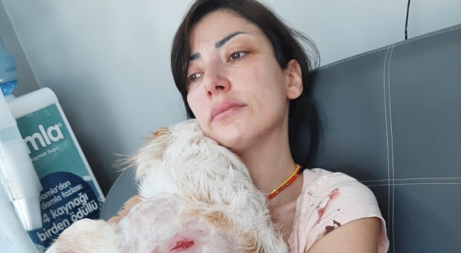 Bursa'da genç kadın ve köpeği, 2 kangalın saldırısına uğradı