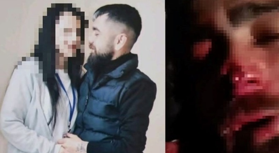 Eski sevgiliye işkence! "Çiğ çiğ yiyeceğim" dedi, kulağı ve burnunu koparttı