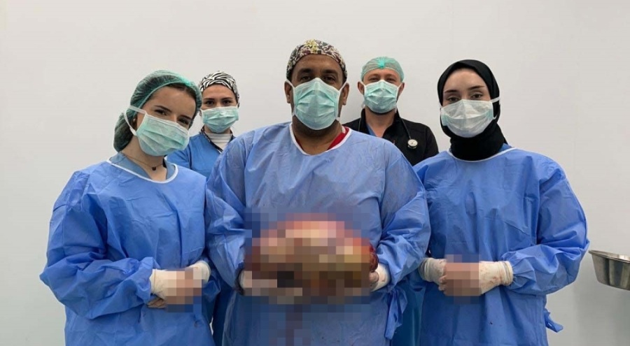 Bursa'da hastanın karnındaki 10 kilogramlık kitle ameliyatla alındı
