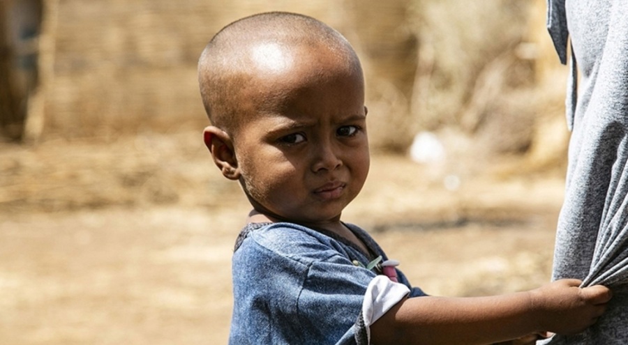 Sudanlı çocuklar açlık ve hastalık yüzünden risk altında