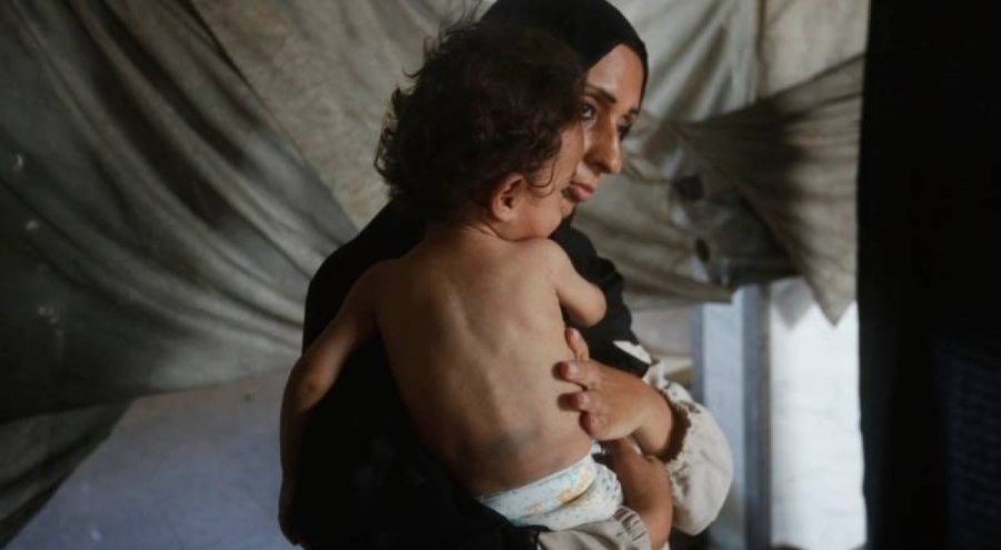 Gazze'de son 24 saatte biri çocuk, 8 kişi daha açlıktan yaşamını yitirdi