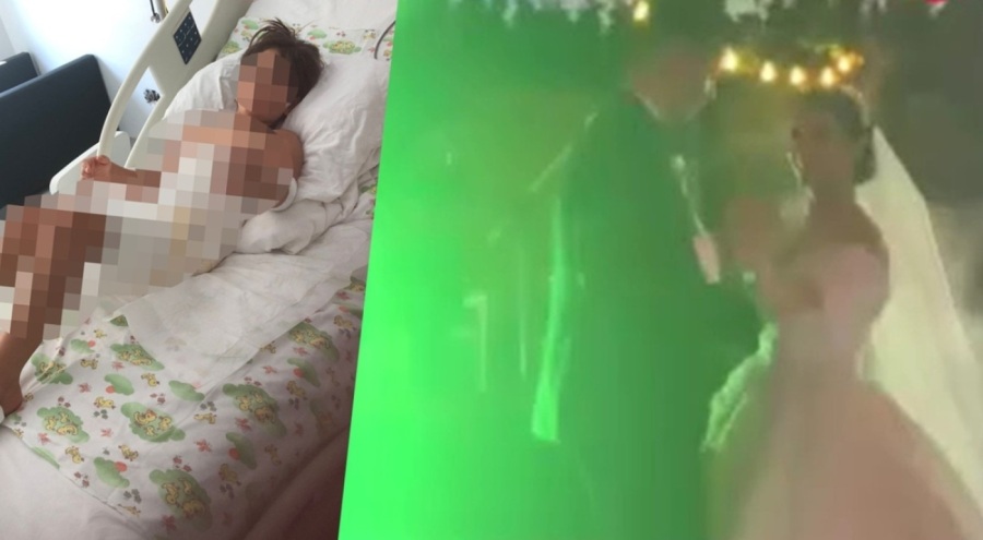 Düğünde dehşet:  Sıvı azot küçük kızı yaktı