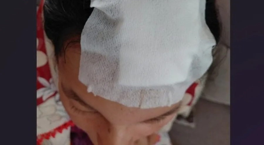 Yazlıkçı aileye aidat dayağı!