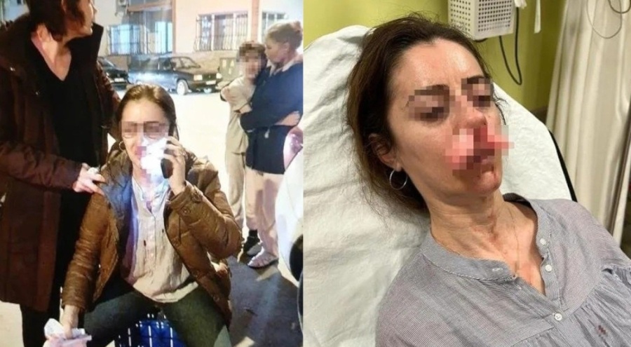 Edirne'de bir kişi, eşinin sevgilisi sandığı kadını otomobil kapısıyla darbetti!