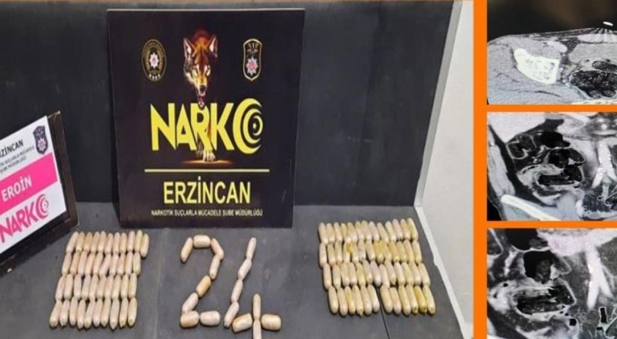 Narkotik operasyonu: Midelerinden çıkanlar şoke etti