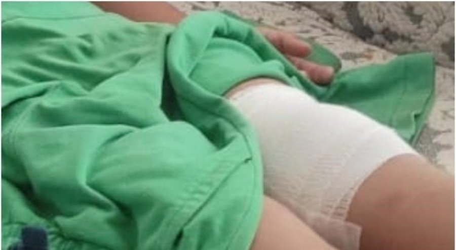Bursa'da sahipsiz köpeğin saldırdığı çocuk yaralandı