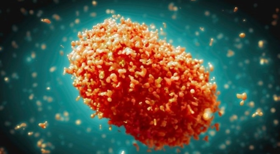 DSÖ'den M çiçeği virüsü uyarısı