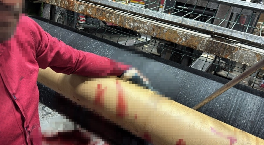 Bursa'da silindir makinasına elini kaptıran işçi ağır yaralandı