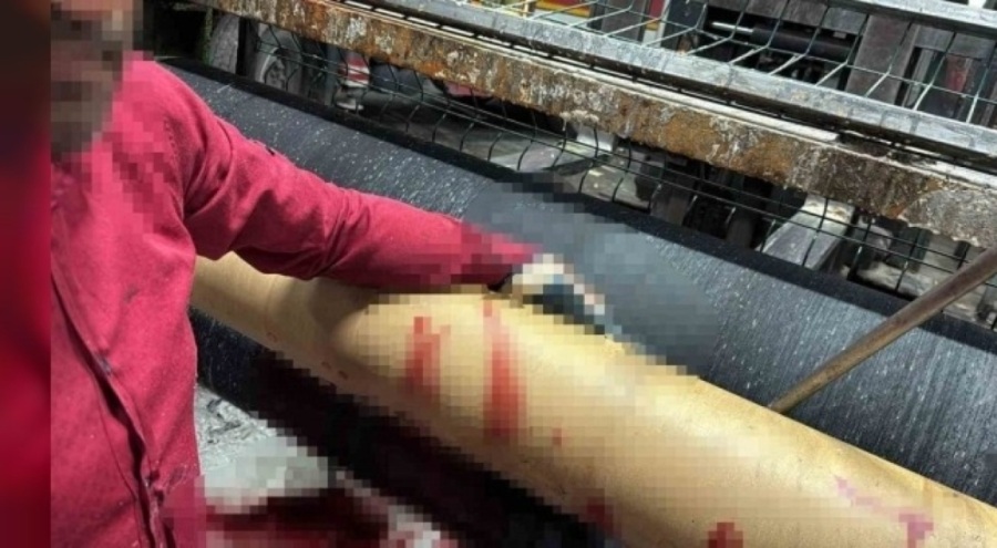 Bursa'da elini silindir makinesine kaptıran mobilya işçisi yaralandı