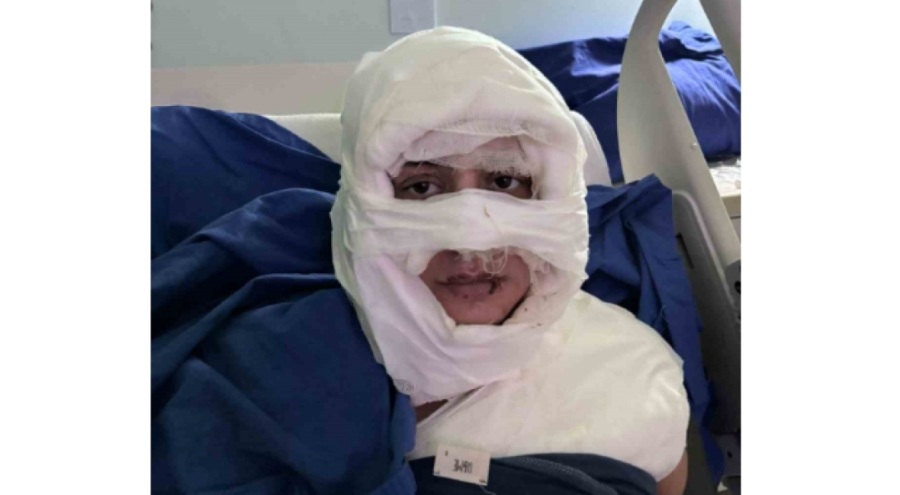 İstanbul'da akıl almaz olay: Genç kadın başka bir kadın tarafından ateşe verildi