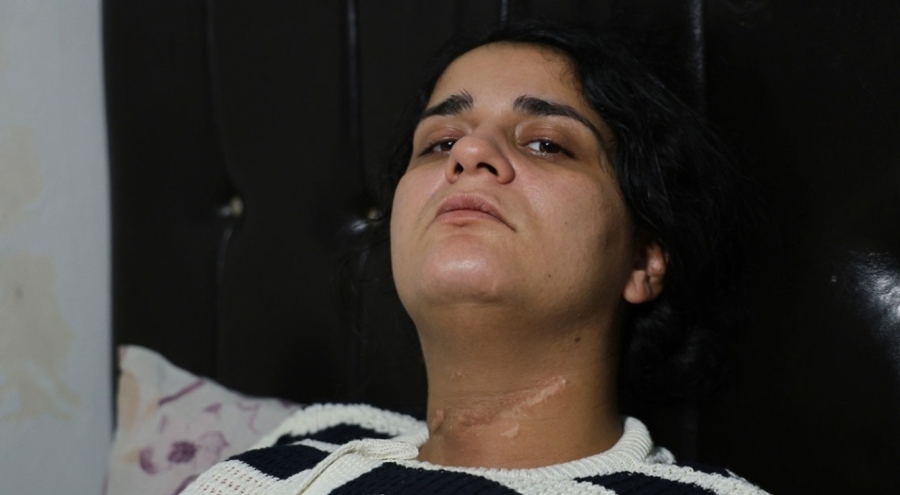 Ayrıldığı erkek tarafından boğazı kesilen Nazmiye, yüzde 96 engelli kaldı
