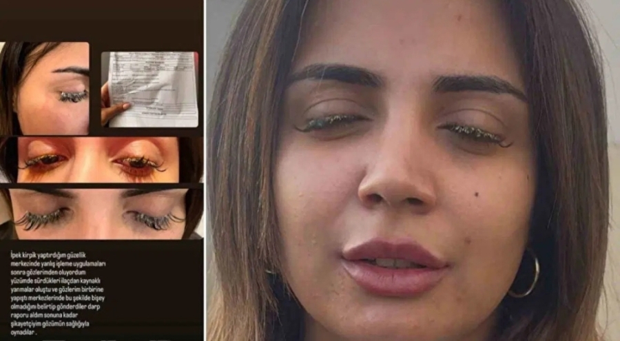 Kirpiklerini yaptırmaya giden kadın kabusu yaşadı!