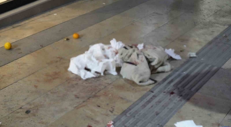 Boşanma aşamasındaki eşi tarafından bıçaklanan kadın yaralandı