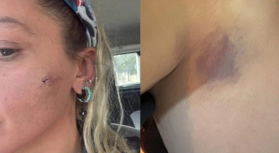 Oyuncu Yıldız Asyalı eşinden şiddet gördüğünü açıkladı