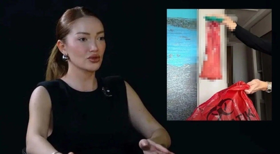 Danla Bilic'ten 'kalça dolgusu' uyarısı