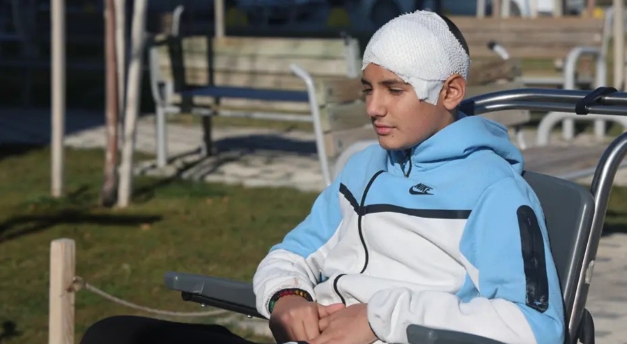 Akran zorbalığı sonrası kafatası titanyum parçalarıyla yeniden oluşturuldu