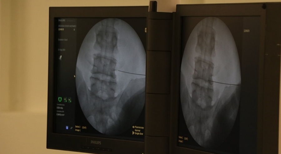 Fıtıkla uzun süre yaşamak ciddi riskler doğuruyor