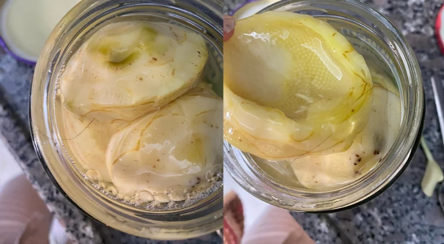 Ünlü markadan hijyen skandalı: Bursa'da alınan konserve içinden saç çıktı