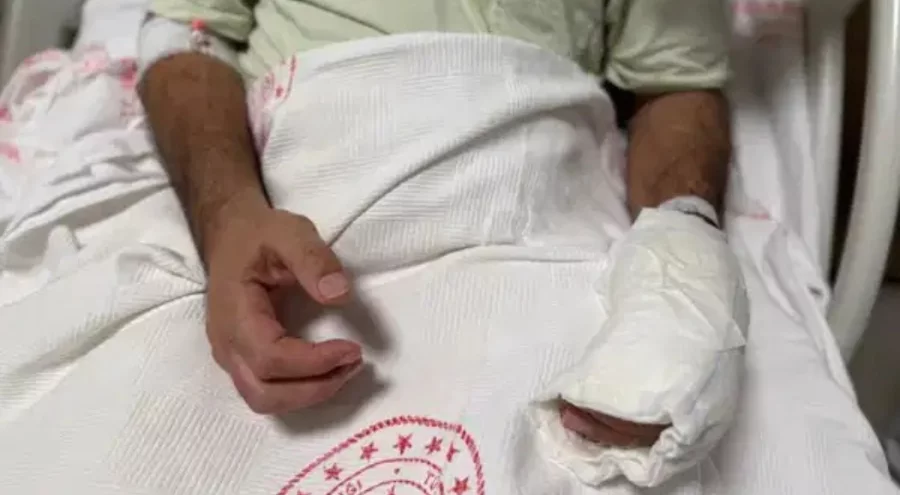 Sıcak torbası patlamasıyla vücudunun yüzde 30'u yandı!