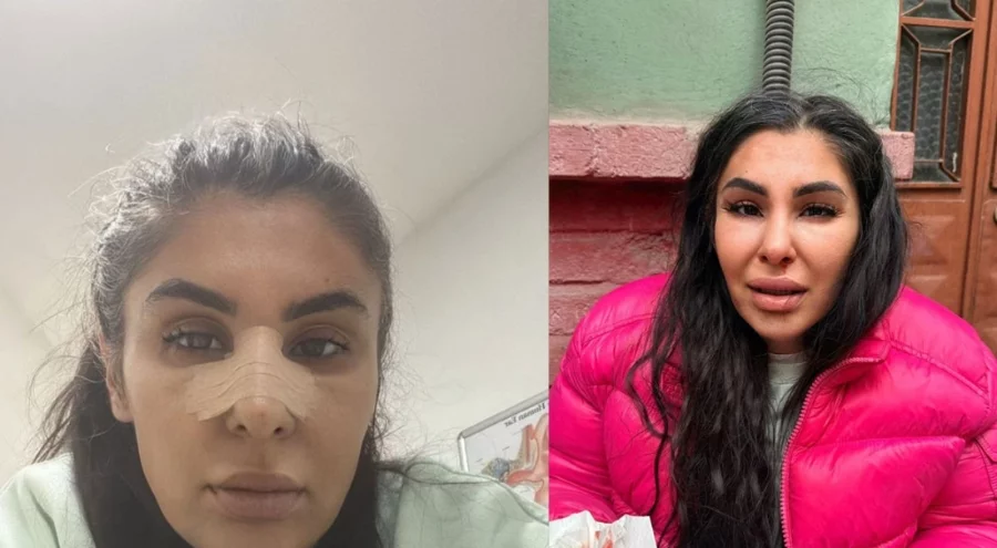 İlişkisini bitirmek istedi darbedilip burnu kırıldı!