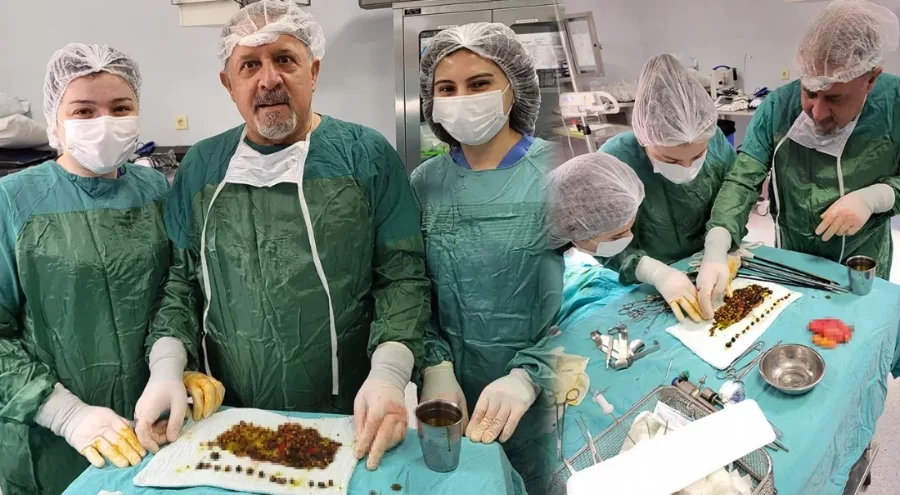 Manisa'da karın ağrısıyla gitti, safrasından binlerce taş çıktı