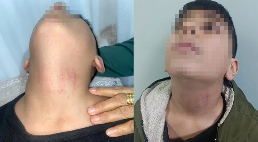 İstanbul'da kadın memurun 10 yaşındaki öğrenciyi okulda darbettiği iddiası