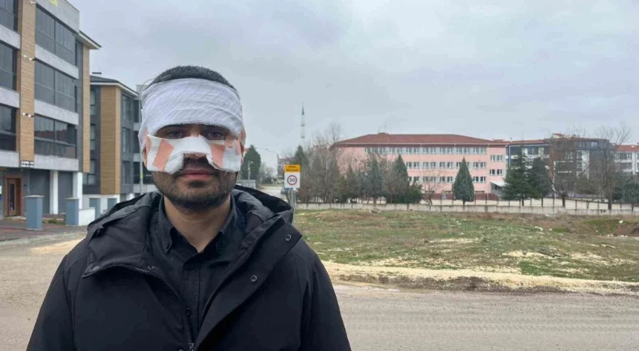 Okulda dehşet! Rehber öğretmen, Fizik öğretmenini kaynar çayla haşladı