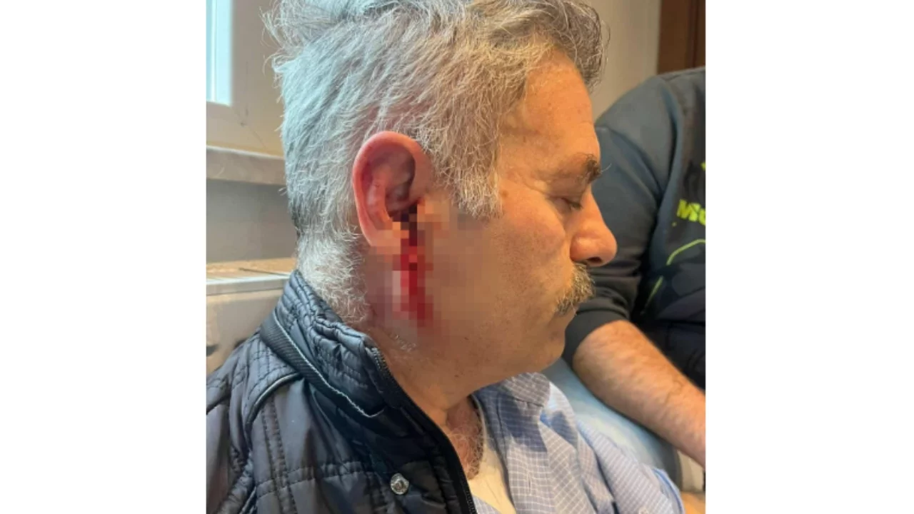 İstanbul'da özel bakım merkezine çağrılan eski çalışan darbedildi