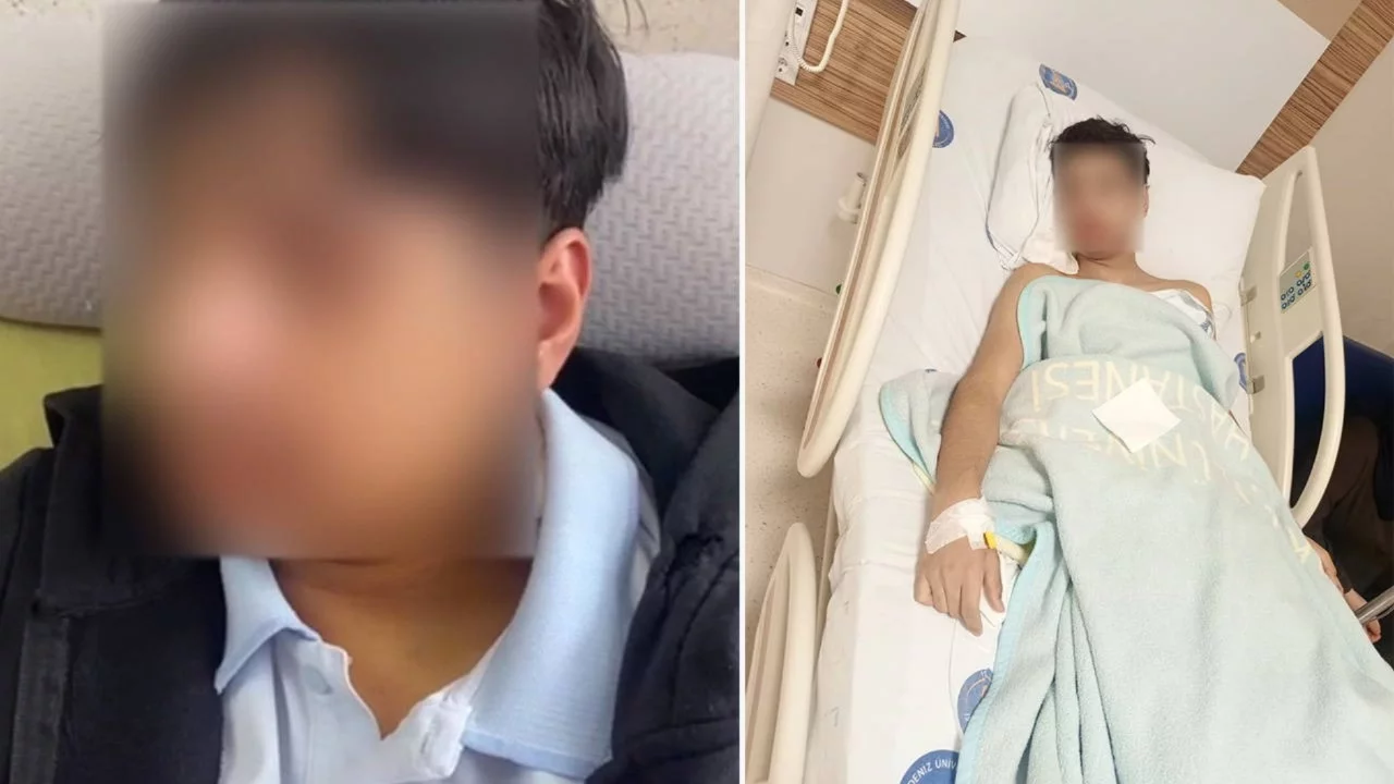 Antalya'da bir okulda akran zorbalığı iddiası: 15 yaşındaki öğrencinin çenesi kırıldı