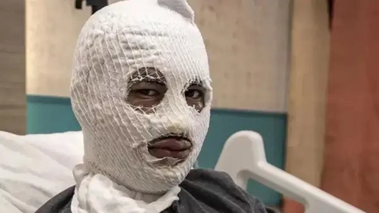 Elindeki gaz tüpü bomba gibi patladı!